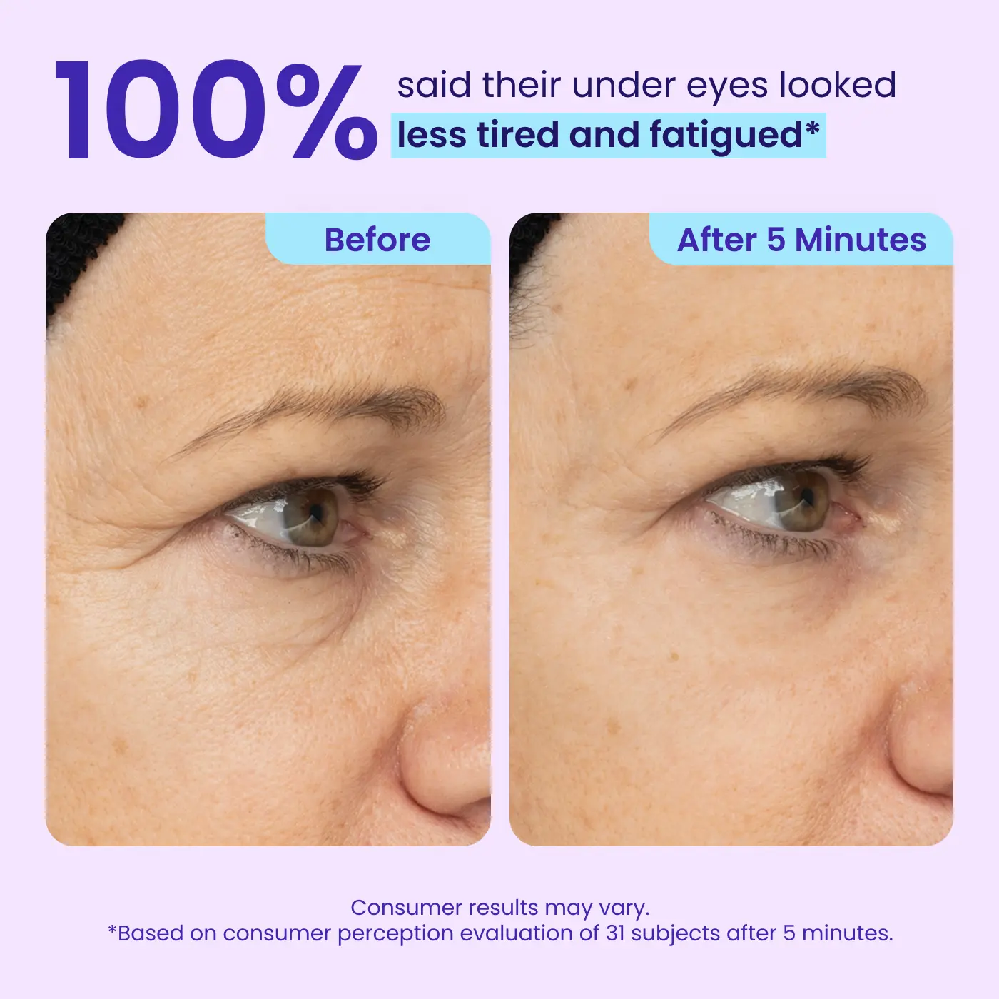 Erase Eye Bags in Minutes — SEAGRIL Eye Cream Look Refreshed Instantly ⚡Flash Sale🔥