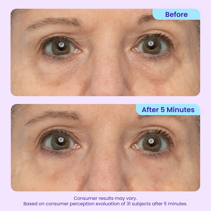 Erase Eye Bags in Minutes — SEAGRIL Eye Cream Look Refreshed Instantly ⚡Flash Sale🔥