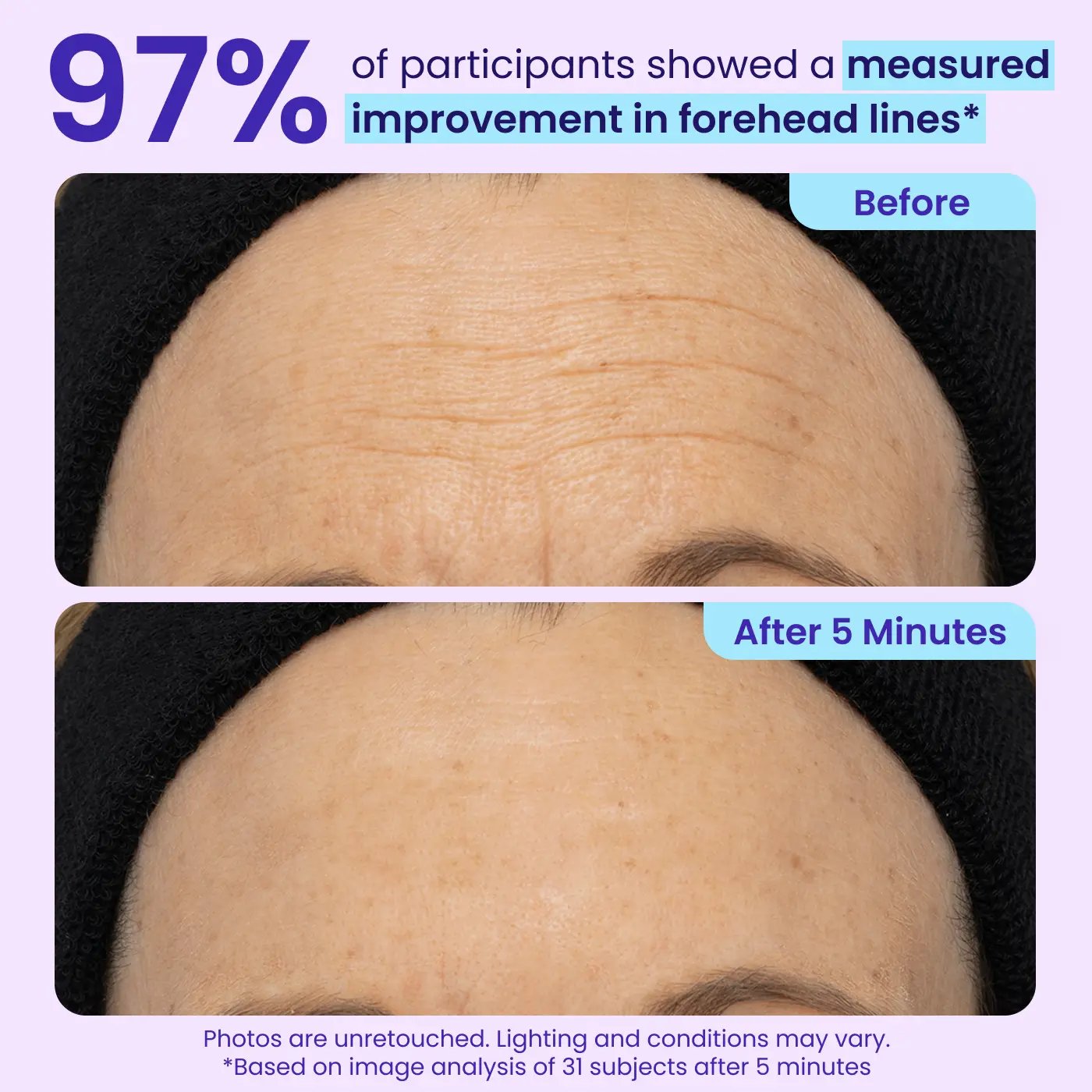Erase Eye Bags in Minutes — SEAGRIL Eye Cream Look Refreshed Instantly ⚡Flash Sale🔥