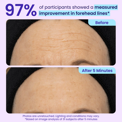 Erase Eye Bags in Minutes — SEAGRIL Eye Cream Look Refreshed Instantly ⚡Flash Sale🔥